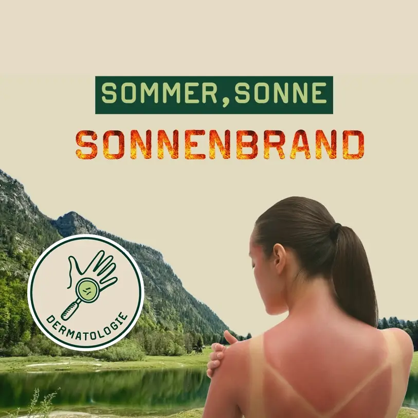 Sonnenbrand Titelbild Teaser Sonnenbrand; Frau mit Sonnenbrand vor dem Weidsee
